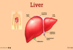 liver transplant