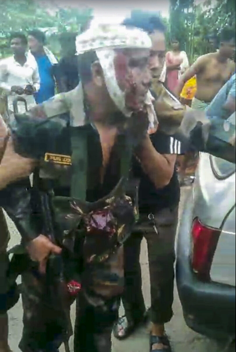 An injured Assam Rifles officer